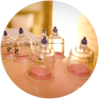 Myofascial Cupping